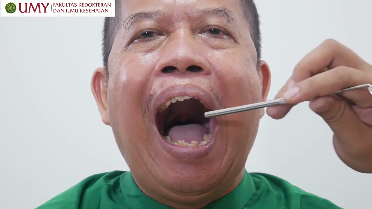 Skills Lab - Pemeriksaan Kepala Leher