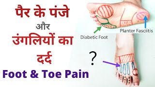 पैर के पंजे और पैर की उंगलियों का दर्द | Foot and toe pain |Dr. vivek Gaur Physiotherapist screenshot 2