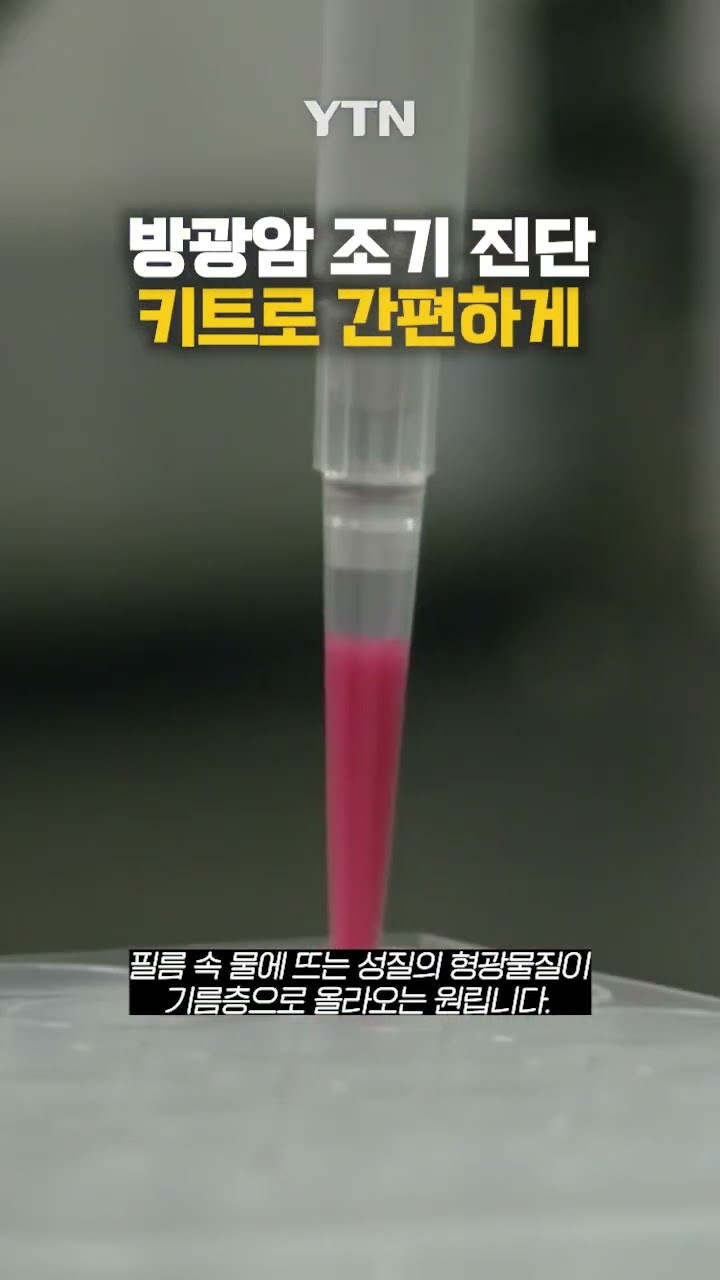 집에서 간편하게 방광암 진단 #shorts / YTN