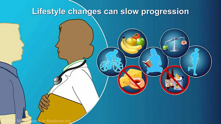 Management and Treatment of Chronic Pancreatitis