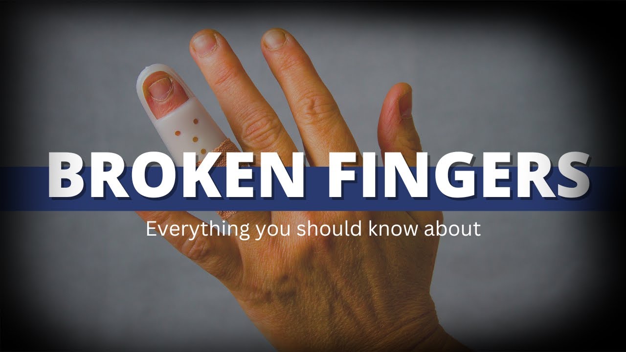 How do you fix a broken finger that healed crooked? YouTube