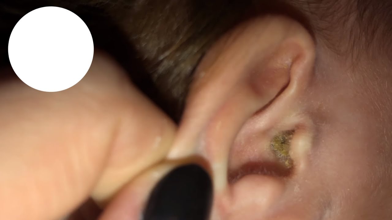 VLOG! у Эми отит?! Температура 39,7! Вызывать скорую?