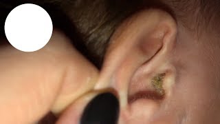 VLOG! у Эми отит?! Температура 39,7! Вызывать скорую? VLOG! у Эми отит?! Температура 39,7! Вызывать скорую?