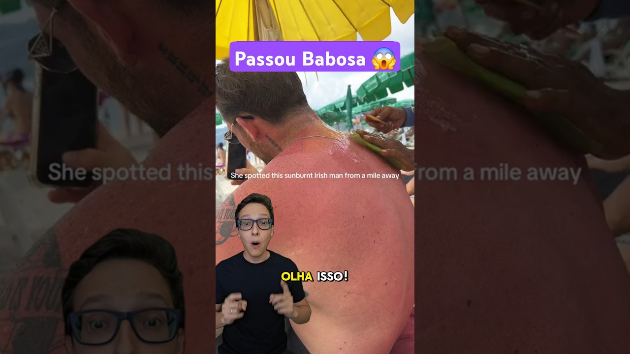 Passou Babosa 😱