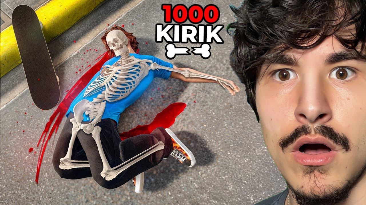 Kaykay Kayarken 1000 Kemik Kırdım!