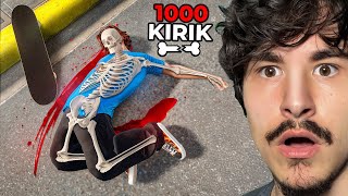 Kaykay Kayarken 1000 Kemik Kırdım