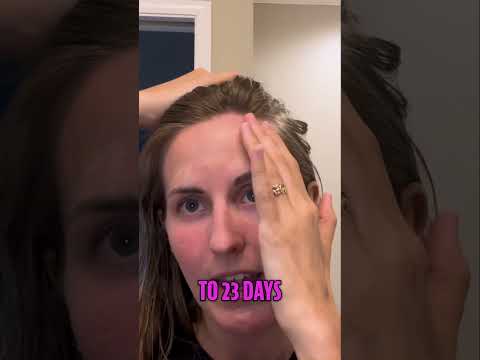 Endometrial Ablation Weight Gain 80