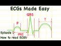 How to read ECGs made easy Episode 1