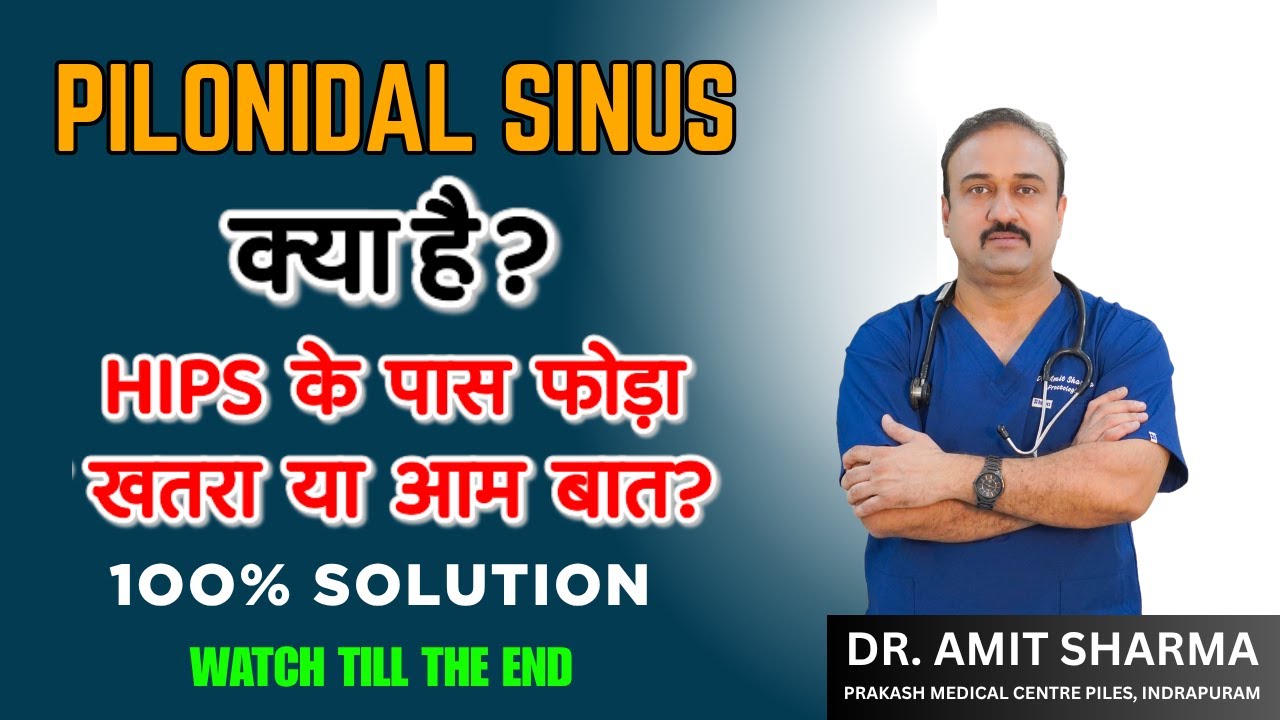 Pilonidal Sinus: क्या ये सिर्फ फोड़ा है या कुछ और गंभीर? जानिए इसके लक्षण, कारण और इलाज