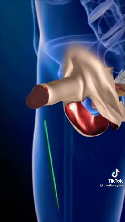 Cirugía Cambio De Sexo Tik Tok 2021