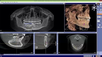 Galileos Galaxis Basics 5: Nerve Mapping