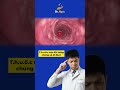 Thuốc sau khi uống xong chúng sẽ đi đâu? | Dr Ngọc #short #shorts #drngoc