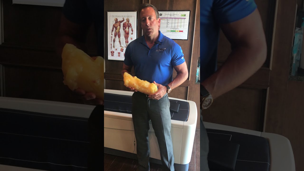 Methods of Measuring Body Composition - Body Fat and Lean Mass - YouTube