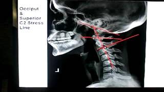 3-Dimensional X-ray Analysis