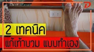 [คลิป 98] 2 เทคนิค แก้เท้าบวม