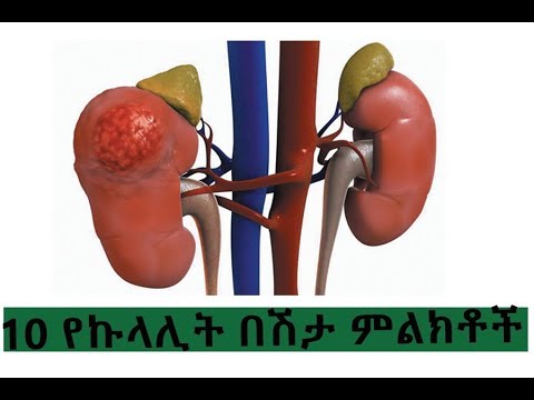 ቪዲዮ: አረንጓዴ ሞላሰስ - የዚህ ማር ሽሮፕ 10 የጤና ጠቀሜታዎች