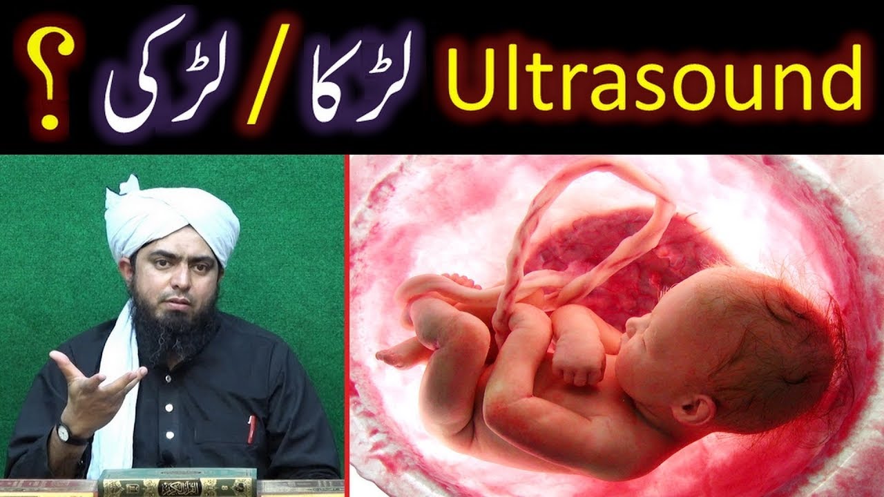 ILM e GHAIB Vs Ultrasound Gynecologist & Baby BOY Vs Baby GIRL by