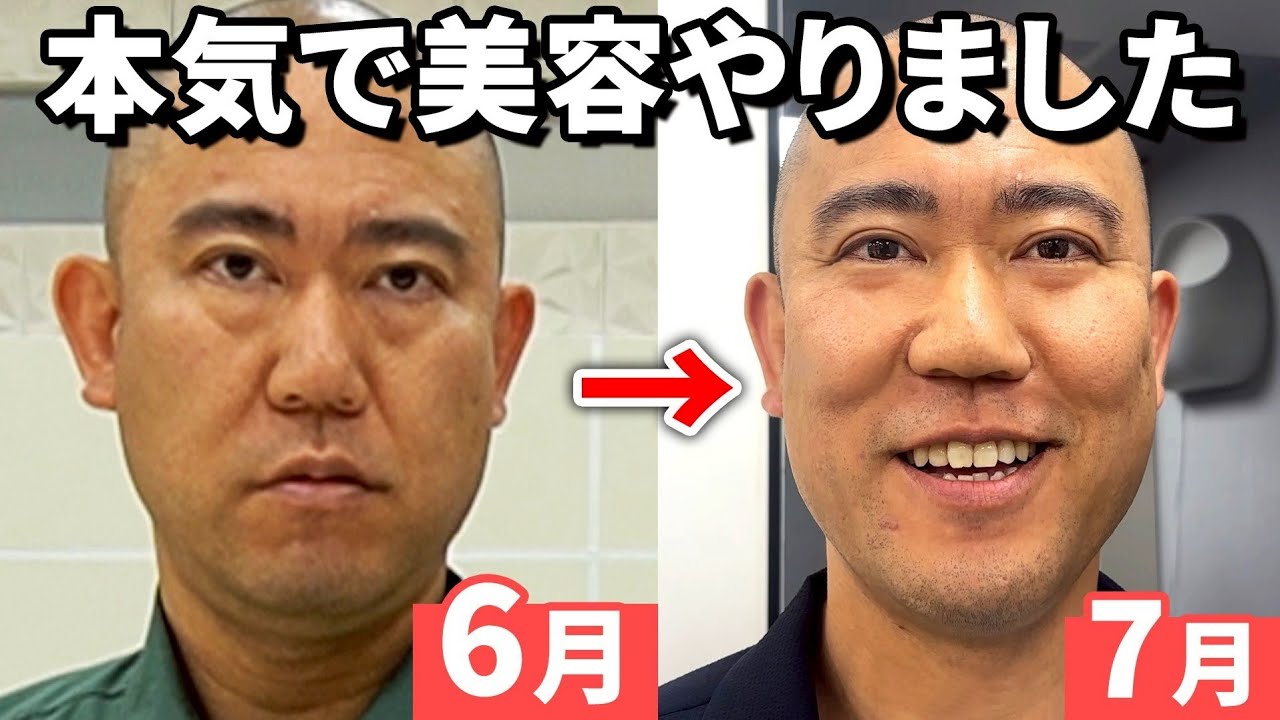 【顔変わりすぎ】ナダルが本気でアンチエイジングして生まれ変わりました【コロチキ】