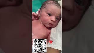 Baby’s First Little Movements After Birth 👶✨ | baby Cute Reaction #viralvideo #newbornbaby #babyboy