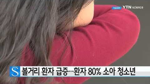 볼거리 환자 급증…환자 80％ 소아 청소년 / YTN 사이언스