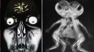 இப்படியொரு X-ray பார்த்துள்ளீர்களா... X-ray vicky fm screenshot 2