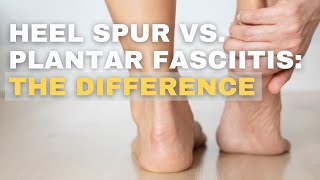 Heel Spur Vs. Plantar Fasciitis - Understanding The Difference