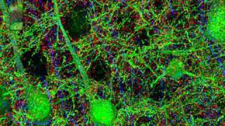 Synaptaesthesia
