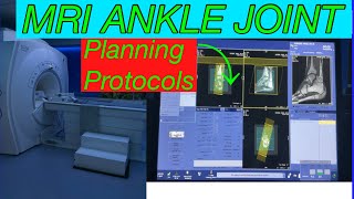 MRI ANKLE JOINT PLANNING step by step #Mri Ankle joint protocols and planning @Mri ankle joint plan