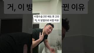 비염수술 2번 해도 못 고친 거, 이 방법으로 바뀐 이유#비염 #코막힘 #비염수술 #호흡개선 #건강관리