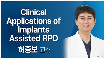 Clinical Applications of Implants Assisted RPD 1강 Preview [#Dentalbean]