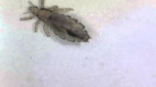 Head lice under a digital microscope