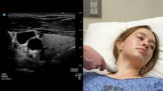 Point-Of-Care Ultrasonography Of Jugular Venous Pressure