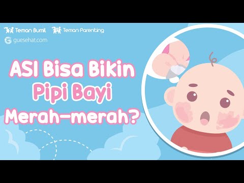 Apakah ASI Jadi Penyebab Pipi Bayi Merah?