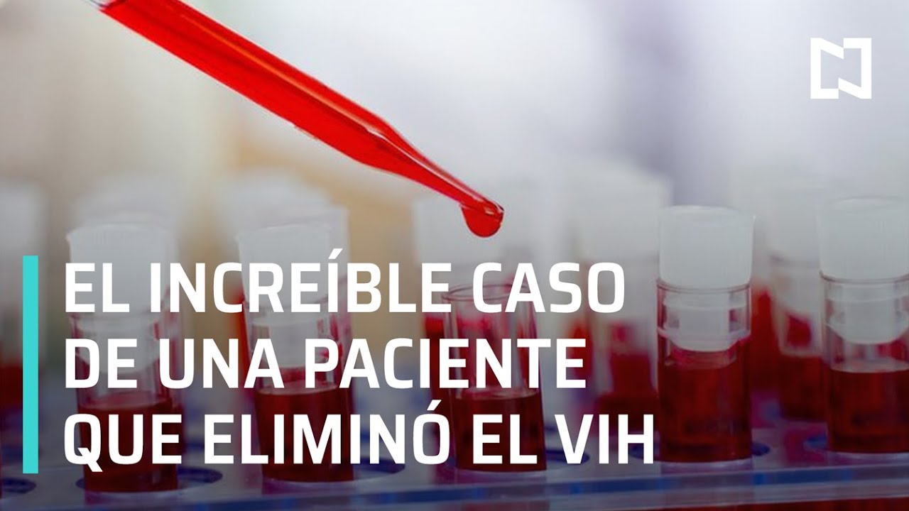 La ‘Paciente esperanza’ que logró eliminar el VIH sin medicamentos - En Punto