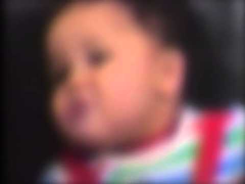 http://clinicaltrials.gov Congenital Ocular Motor Apraxia
