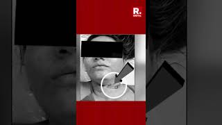 '-80°’ Excuse in Twisha’s Death Report Shredded | Forensic Expert Reveals