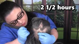 ASMR Scalp Check and Treatment Compilation (Scalp Massage, Whispering)  Medical Roleplay