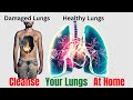 How to Detoxify Your Lungs Naturally - Clear Your Lungs Of Phlegm