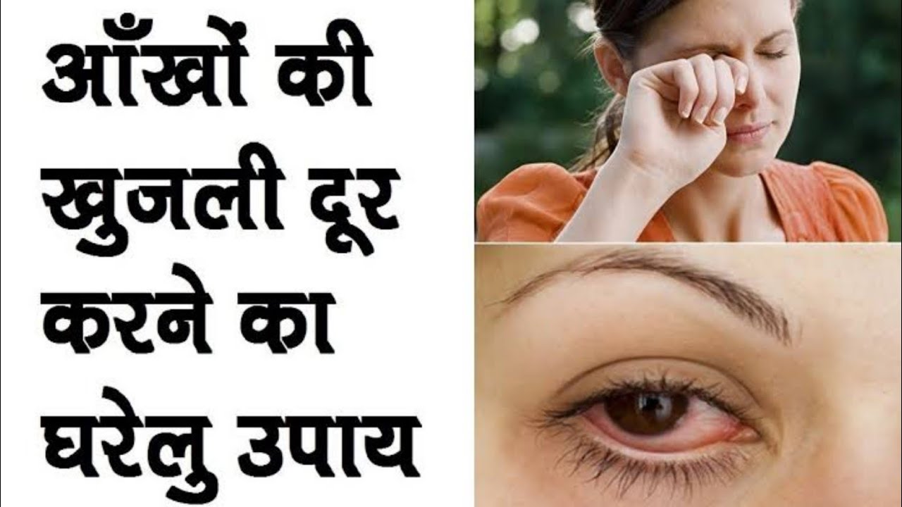 Eye Itching Home Remedy Eye infection treatment Aankho ki khujli ka