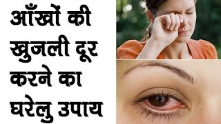 Eye Itching Home Remedy | Eye infection treatment | Aankho ki khujli ka ilaj in hindi | Ayurveda 2M