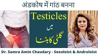 Testicular Lump | Testicular Cancer or Varicocele