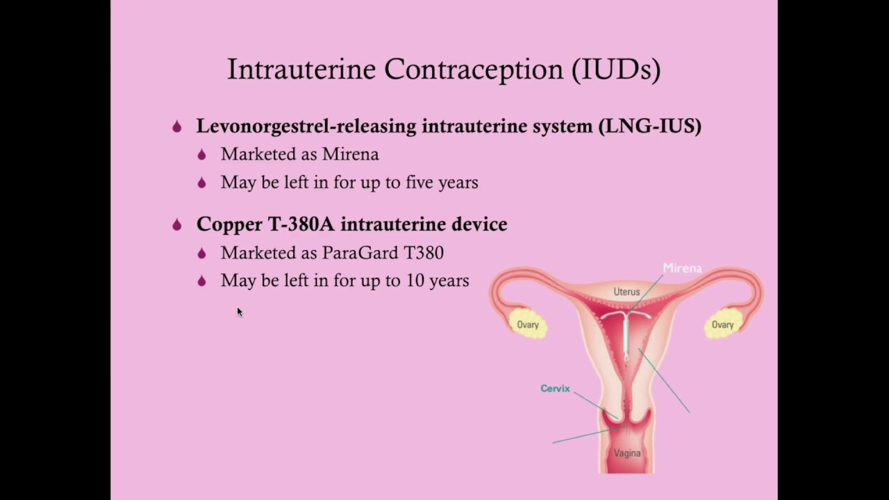 Contraception - CRASH! Medical Review Series