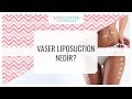 Vaser Liposuction Nedir?