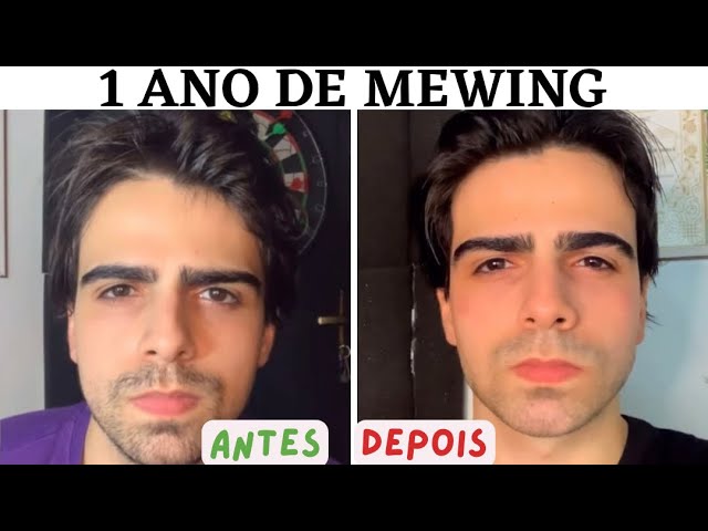 Como definir a mandíbula MEWING 2019 