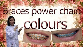 Braces power chain colors