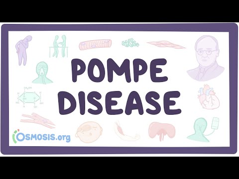 Pompe disease - causes, symptoms, diagnosis, treatment, pathology