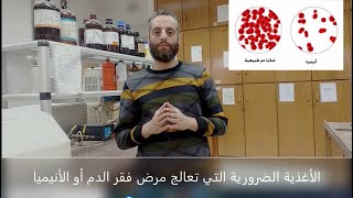 الأغذية الضرورية التي تعالج مرض فقر الدم أو الأنيميا