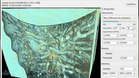 Volume Rendering Cardiovascular Visualization