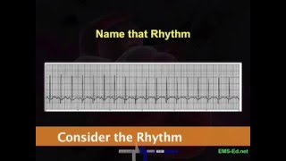 Intro EKG Interpretation Part 2