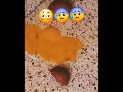 اهرب على فين اهرب من تحت عقب الباب مش حا يجي على مقاسي